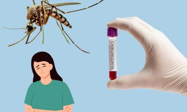 Khánh Hòa tăng cường phòng chống bệnh Chikungunya 